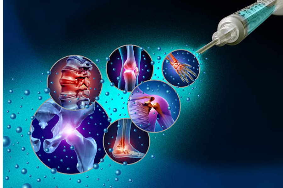 Medicina Regenerativa em Paraíso do Tocantins: Tratando a Causa Real da sua Dor