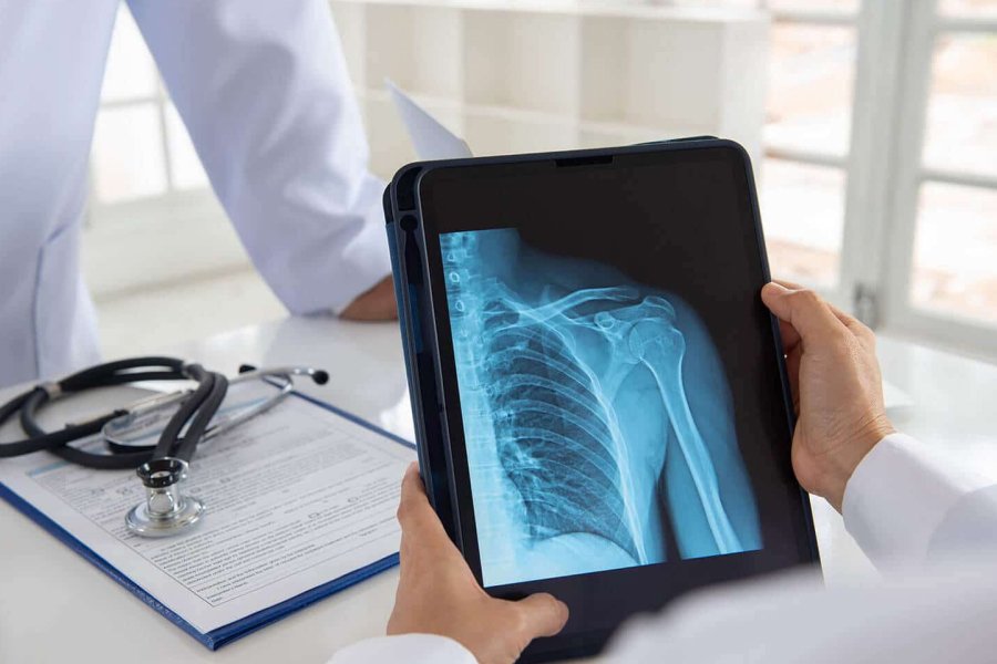 Raio-X Digital em Paraíso do Tocantins: Precisão Diagnóstica e Tecnologia a Serviço da Vida