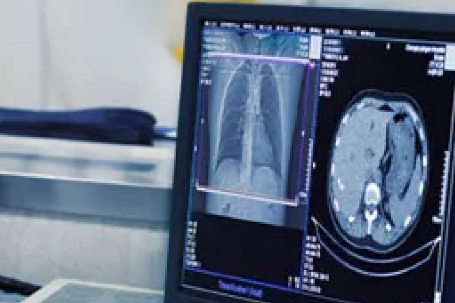 Tomografia Computadorizada em Paraíso do Tocantins: Tecnologia, Segurança e Diagnóstico Preciso